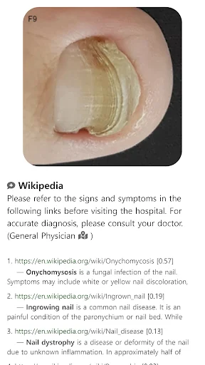 Baixar Model Dermatol – Atlas de Doenças de Pele Grátis - Screenshot 14