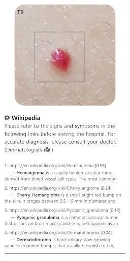 Baixar Model Dermatol – Atlas de Doenças de Pele Grátis - Screenshot 5