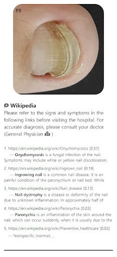 Baixar Model Dermatol – Atlas de Doenças de Pele Grátis - Screenshot 1