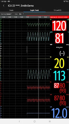 Download Mindray Mobile Viewer: Monitoramento Médico Remoto - Screenshot 23